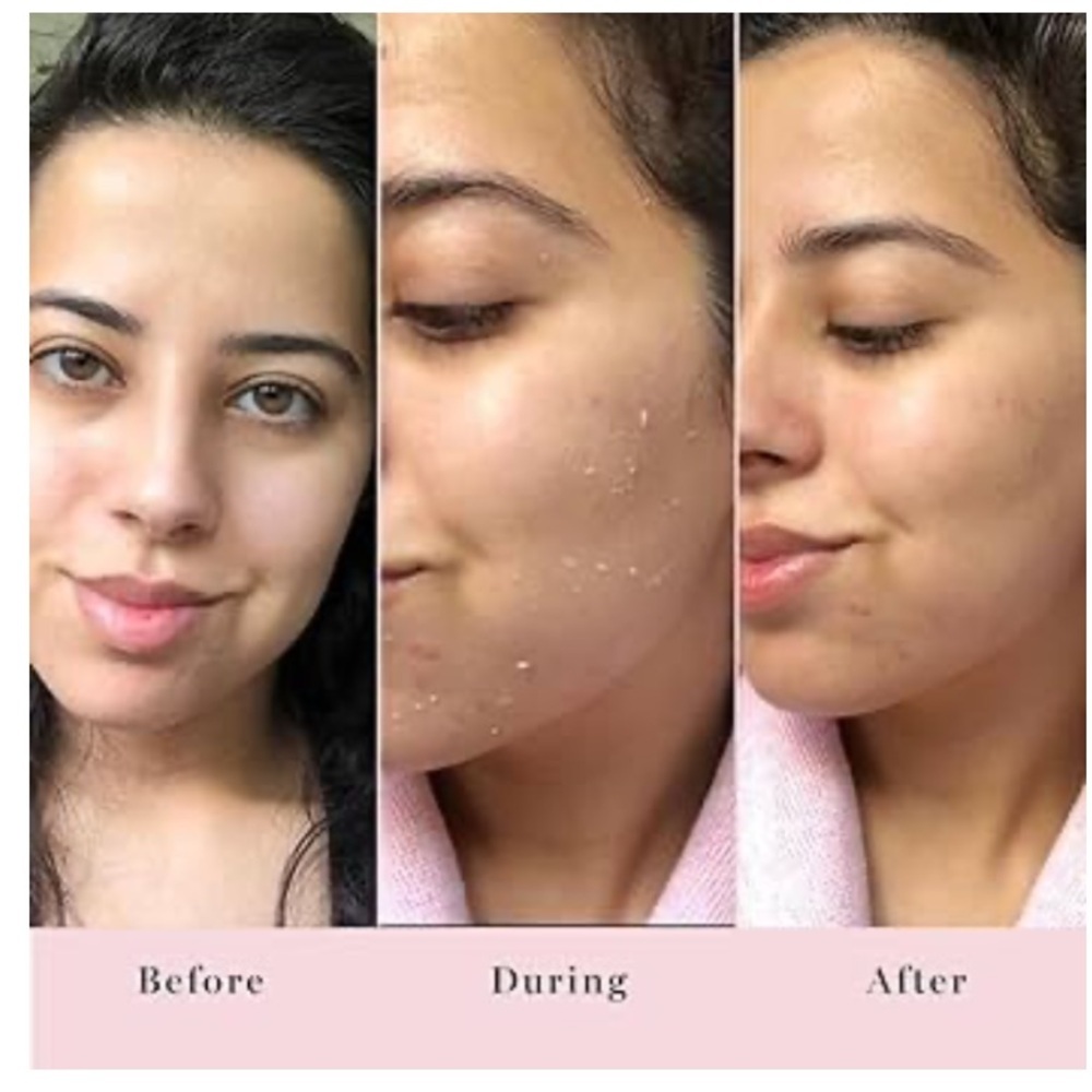 Saturday Skin New Rub A Dub Refining Peel Gel Facial Exfoliator - Picture 4 of 13